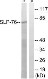 Western blot analysis of lysates from Jurkat cells, treated with EGF 200 ng/ml 5' using Anti-SLP-76 Antibody. The right hand lane represents a negative control, where the Antibody is blocked by the immunising peptide