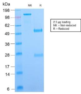 SDS-PAGE analysis of Anti-B7H4 Antibody [B7H4/2652R] under non-reduced and reduced conditions; showing intact IgG and intact heavy and light chains, respectively. SDS-PAGE analysis confirms the integrity and purity of the antibody