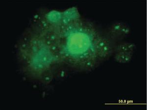 Anti-ALDOA Mouse Monoclonal Antibody [clone: 3C12-6D11]