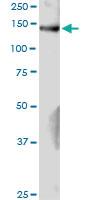 Anti-GAK Rabbit Polyclonal Antibody