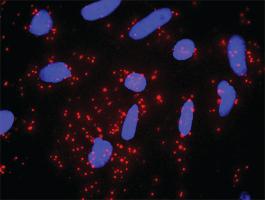 Anti-HSPB1 + DAXX Antibody Pair