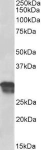 Anti-CCND1 Antibody (A85171) (05 µg/ml) staining of Human Placenta lysate (35 µg protein in RIPA buffer) Primary incubation was 1 hour Detected by chemiluminescence