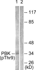 Western blot analysis of lysates from K562 cells treated with UV 30' using Anti-PBK (phospho Thr9) Antibody. The right hand lane represents a negative control, where the antibody is blocked by the immunising peptide.