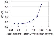 Anti-CASQ1 Mouse Monoclonal Antibody [clone: 1D7]