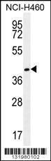 Anti-GGH Rabbit Polyclonal Antibody (Biotin)