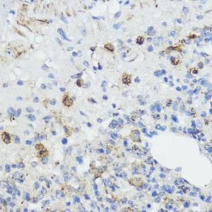 Immunohistochemistry analysis of paraffin-embedded rat lung using Anti-Frataxin Antibody (A93224) at a dilution of 1:100 (40x lens). Perform microwave antigen retrieval with 10 mM PBS buffer pH 7.2 before commencing with IHC staining protocol