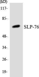 Western blot analysis of the lysates from HT 29 cells using Anti-SLP-76 Antibody