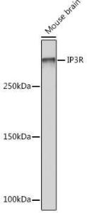 Western blot analysis of extracts of Mouse brain, using Anti-IP3 receptor Antibody [ARC1007] (A306244) at 1:1,000 dilution