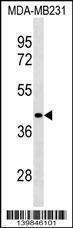 Anti-LRRC39 Rabbit Polyclonal Antibody (Biotin)