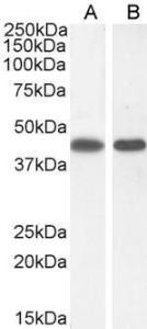 Anti-ASS1 Antibody (A83511) (0.3 µg/ml) staining of A431 (A) and (1 µg/ml) NIH3T3(B) cell lysate (35 µg protein in RIPA buffer). Detected by chemiluminescence