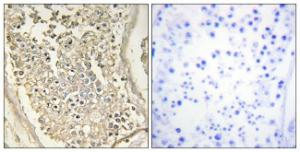 Immunohistochemical analysis of paraffin-embedded human testis tissue using Anti-ATP7B Antibody. The right hand panel represents a negative control, where the antibody was pre-incubated with the immunising peptide.