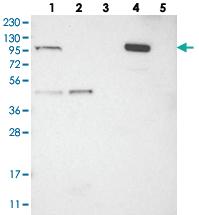 Anti-C1ORF112 Rabbit Polyclonal Antibody