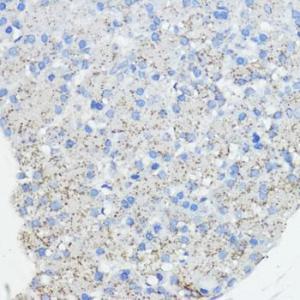 Immunohistochemistry analysis of paraffin-embedded rat pancreas using Anti-Frataxin Antibody (A93224) at a dilution of 1:100 (40x lens). Perform microwave antigen retrieval with 10 mM PBS buffer pH 7.2 before commencing with IHC staining protocol