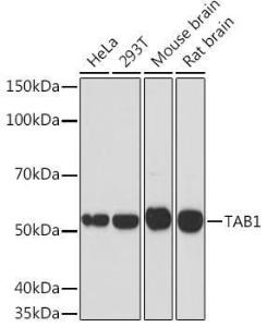 Western blot analysis of extracts of various cell lines, using Anti-TAB1 Antibody [ARC1943] (A309138) at 1:1,000 dilution. The secondary antibody was Goat Anti-Rabbit IgG H&L Antibody (HRP) at 1:10,000 dilution.