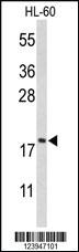 Anti-CFL1 Rabbit Polyclonal Antibody