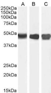 Anti-ASS1 Antibody (A83511) (0.01 µg/ml) staining of Human Kidney (A) Mouse Liver (B) and (0.03 µg/ml) Rat Kidney (C) lysate (35 µg protein in RIPA buffer). Detected by chemiluminescence