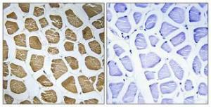 Immunohistochemical analysis of paraffin-embedded human skeletal muscle using Anti-MRPS22 Antibody 1:100 (4°C overnight). The right hand panel represents a negative control, where the antibody was pre-incubated with the immunising peptide.