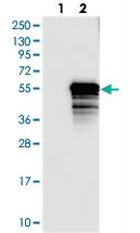 Anti-TEX9 Rabbit Polyclonal Antibody