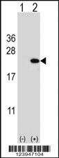 Anti-CFL1 Rabbit Polyclonal Antibody