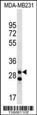 Anti-LRRC3C Rabbit Polyclonal Antibody (APC (Allophycocyanin))