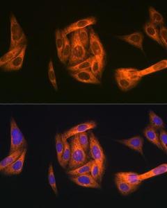 Immunofluorescence analysis of U-2 OS cells using Anti-TAB1 Antibody [ARC1943] (A309138) at a dilution of 1:100 (40x lens). DAPI was used to stain the cell nuclei (blue).