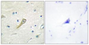 Immunohistochemical analysis of paraffin-embedded human brain tissue using Anti-SEMA4A Antibody The right hand panel represents a negative control, where the antibody was pre-incubated with the immunising peptide