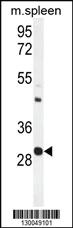 Anti-USF1 Rabbit Polyclonal Antibody