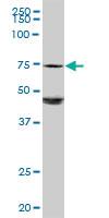 Anti-GALC Rabbit Polyclonal Antibody