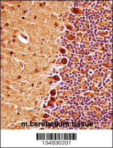 Anti-MAPK9 Rabbit Polyclonal Antibody (PE (Phycoerythrin))