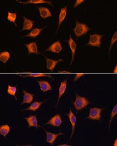 Immunofluorescence analysis of L929 cells using Anti-GBAS Antibody (A93226) at a dilution of 1:100 DAPI was used to stain the cell nuclei (blue)