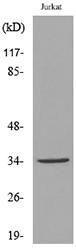 Western blot analysis of lysate from Jurkat cells using Anti-APE1 (acetyl Lys7) Antibody