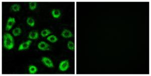 Immunofluorescence analysis of A549 cells using Anti-ATP5D Antibody. The right hand panel represents a negative control, where the Antibody was pre-incubated with the immunising peptide