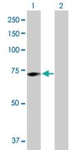 Anti-GALC Rabbit Polyclonal Antibody