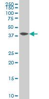 Anti-NFKBIB Mouse Monoclonal Antibody [clone: 2B11]