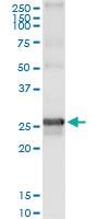 Anti-GSTZ1 Polyclonal Antibody Pair