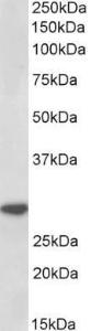 Anti-IL1B Antibody (A85175) (1 µg/ml) staining of Human Peripheral Blood Lymphocytes lysate (35 µg protein in RIPA buffer). Primary incubation was 1 hour. Detected by chemiluminescence