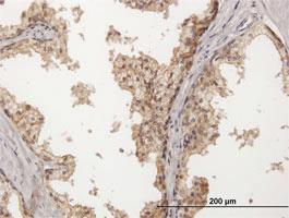 Anti-NECTIN2 Mouse Polyclonal Antibody