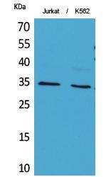 Western blot analysis of Jurkat, K562 cells using Anti-APE1 (acetyl Lys7) Antibody