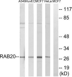 Western blot analysis of lysates from HeLa, MCF-7, HUVEC, and A549 cells using Anti-RAB20 Antibody. The right hand lane represents a negative control, where the antibody is blocked by the immunising peptide.