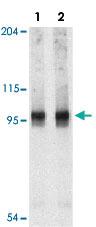 Anti-NLRP2 Rabbit Polyclonal Antibody