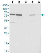 Anti-NOA1 Rabbit Polyclonal Antibody