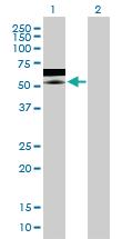 Anti-ZNF358 Mouse Polyclonal Antibody