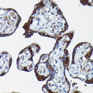 Immunohistochemistry analysis of paraffin-embedded human placenta using Anti-PEG10 / EDR Antibody (A9086) at a dilution of 1:100 (40x lens). Perform high pressure antigen retrieval with 10 mM citrate buffer pH 6.0 before commencing with IHC staining protocol.