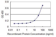 Anti-NFKBIB Mouse Monoclonal Antibody [clone: 2B11]