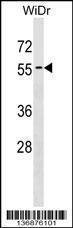 Anti-ATG4D Rabbit Polyclonal Antibody (FITC (Fluorescein Isothiocyanate))