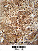 Anti-APCS Rabbit Polyclonal Antibody (FITC (Fluorescein Isothiocyanate))