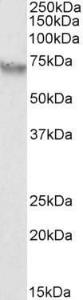 Anti-AFP Antibody (A85176) (0.3µg/ml) staining of HepG2 lysate (35µg protein in RIPA buffer). Primary incubation was 1 hour. Detected by chemiluminescence.