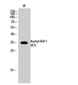 Western blot analysis of JK cells using Anti-APE1 (acetyl Lys7) Antibody