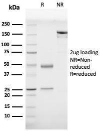 Anti-Prohibitin antibody