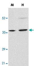 Anti-ENDOG Rabbit Polyclonal Antibody